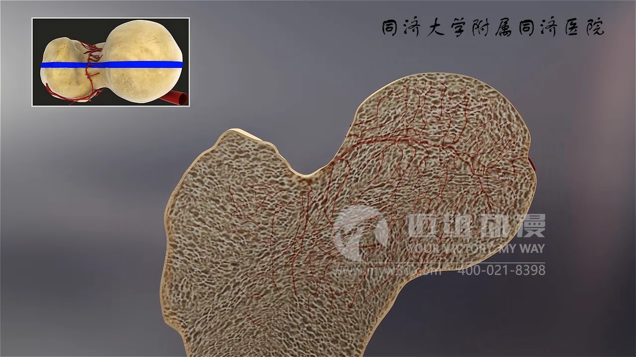 醫(yī)學(xué)三維動畫 醫(yī)學(xué)三維動畫