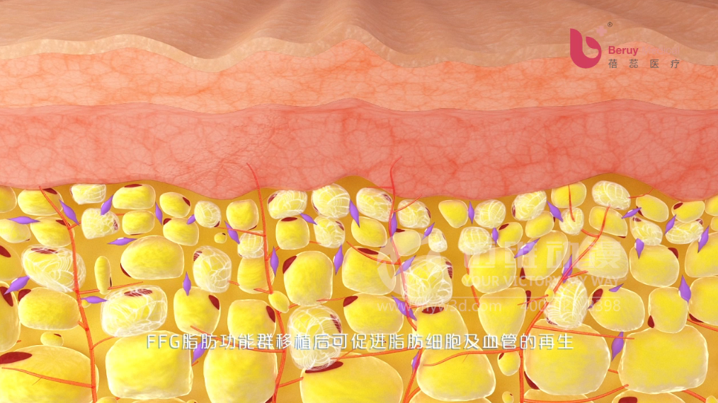醫(yī)學醫(yī)療三維動畫 醫(yī)學醫(yī)療三維動畫