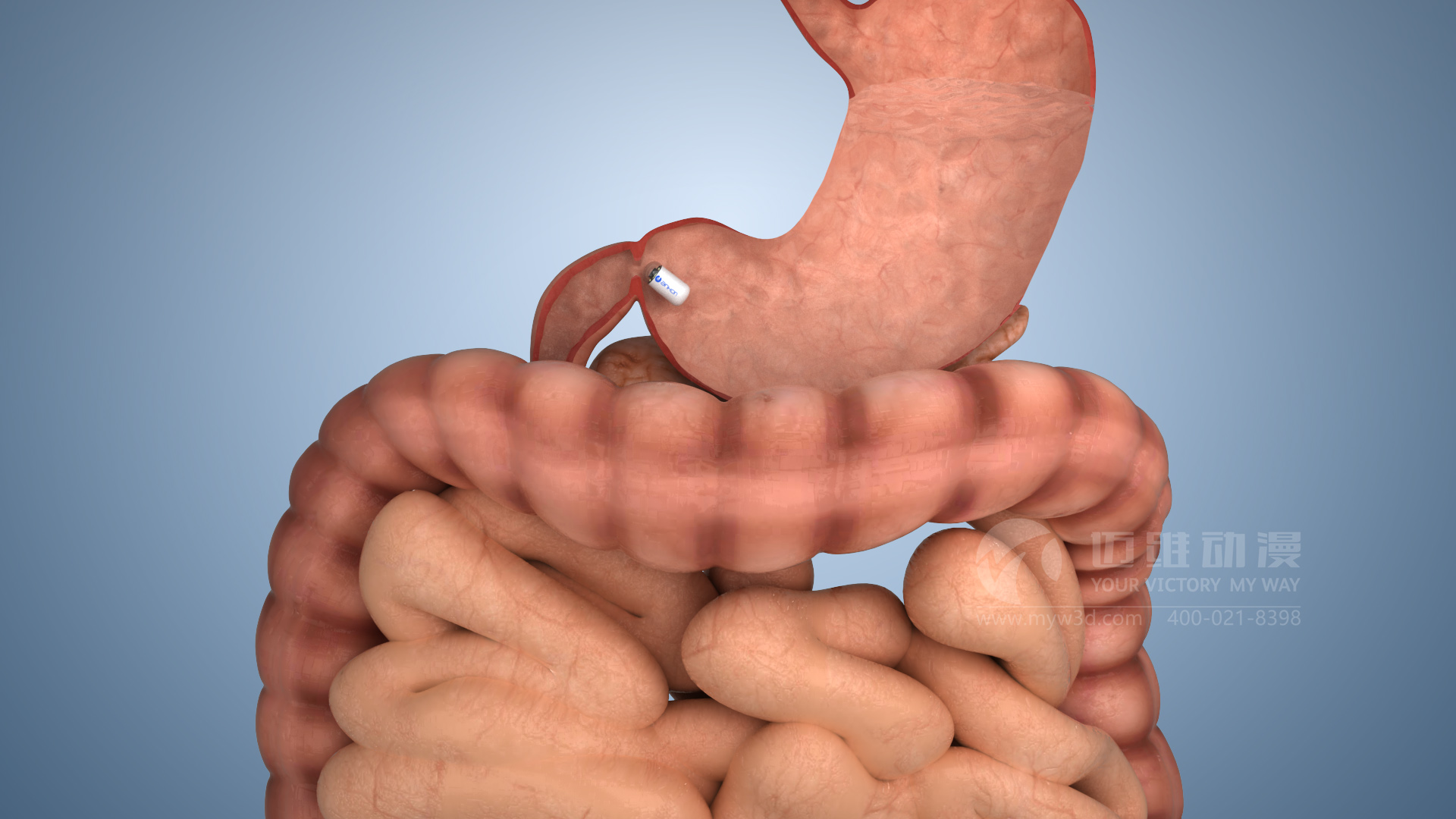 膠囊機器人動畫.jpg 膠囊機器人動畫.jpg