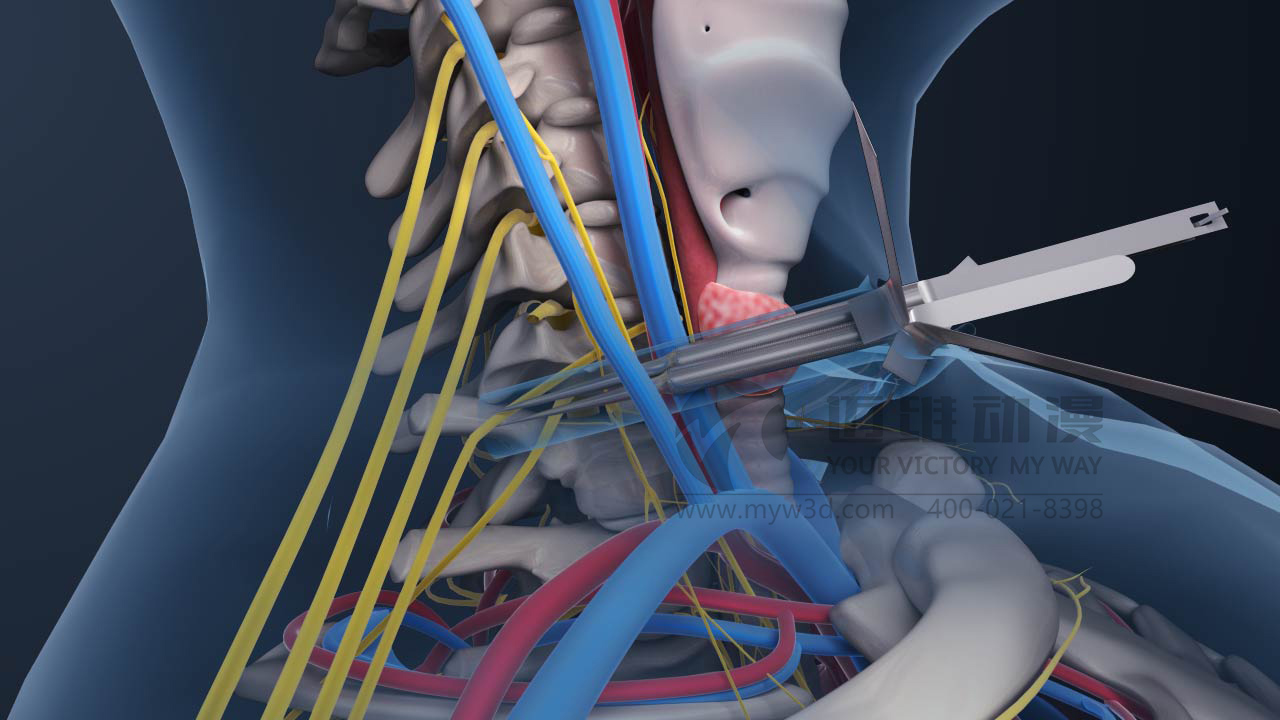 對于醫(yī)療三維動畫你會怎么做？(圖2)