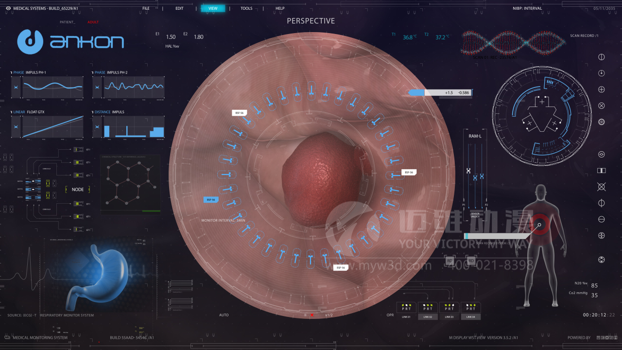 醫(yī)學(xué)醫(yī)療三維動(dòng)畫(huà).jpg 醫(yī)學(xué)醫(yī)療三維動(dòng)畫(huà).jpg