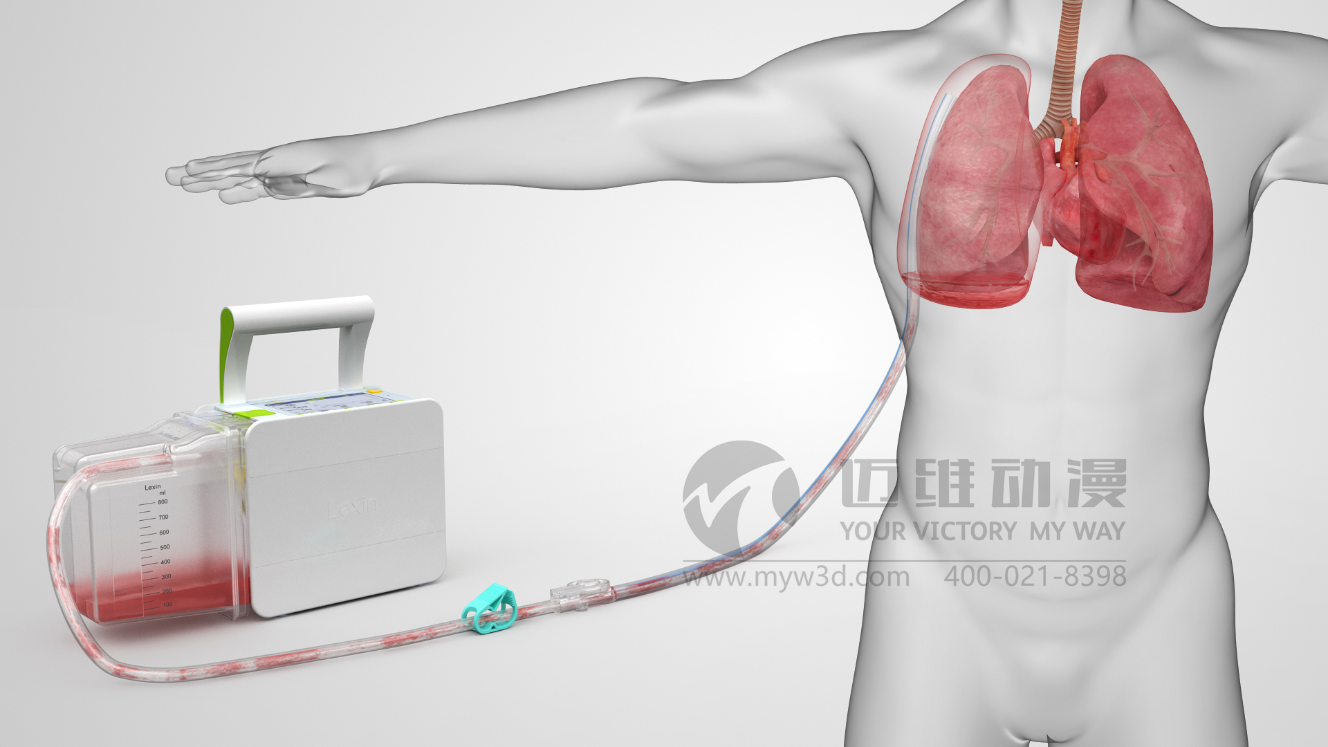 醫(yī)療器械動(dòng)畫(huà).jpg 醫(yī)療器械動(dòng)畫(huà).jpg