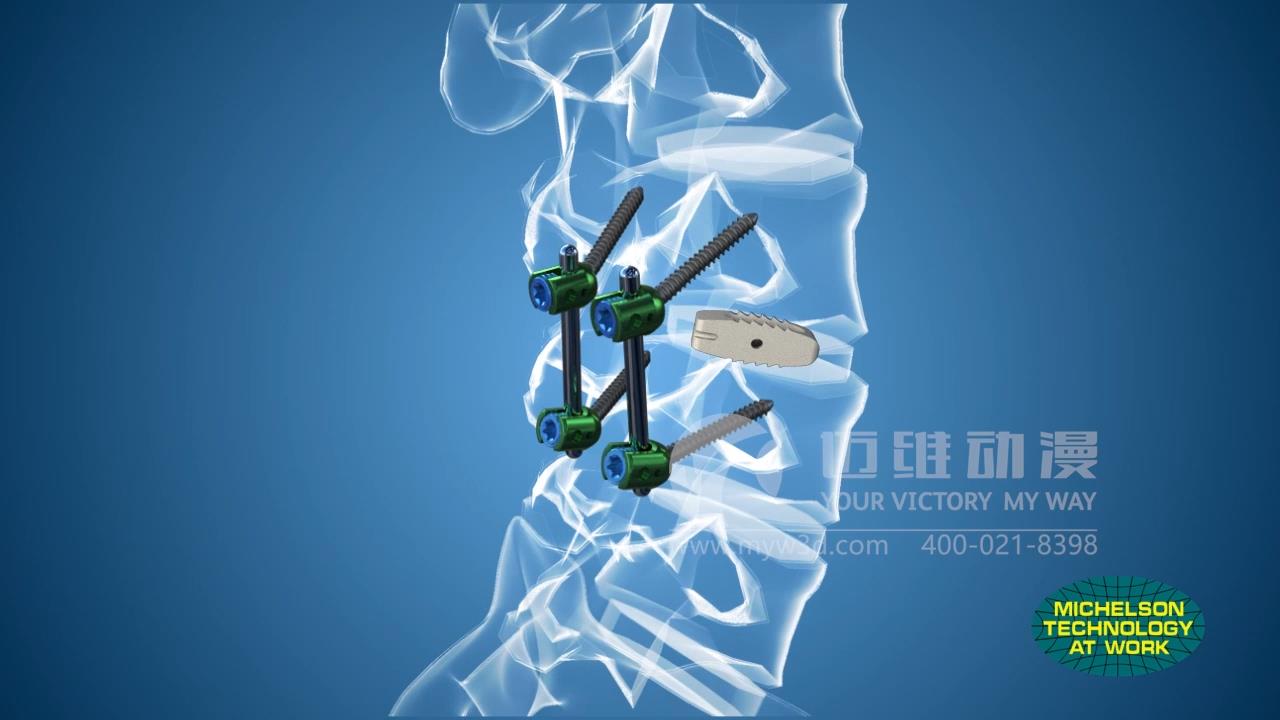 醫(yī)療器械三維動畫.jpg 醫(yī)療器械三維動畫.jpg