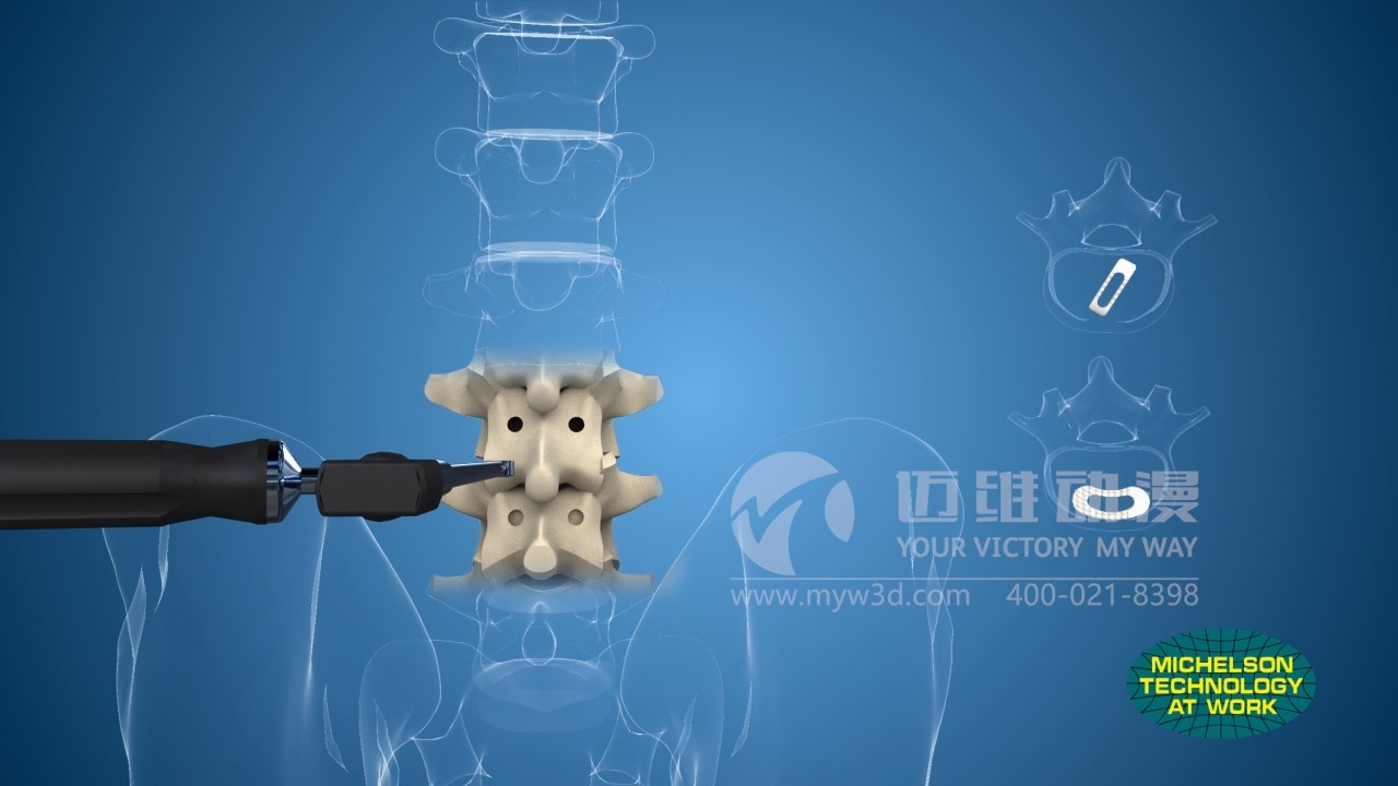 醫(yī)療三維動畫制作.jpg 醫(yī)療三維動畫制作.jpg