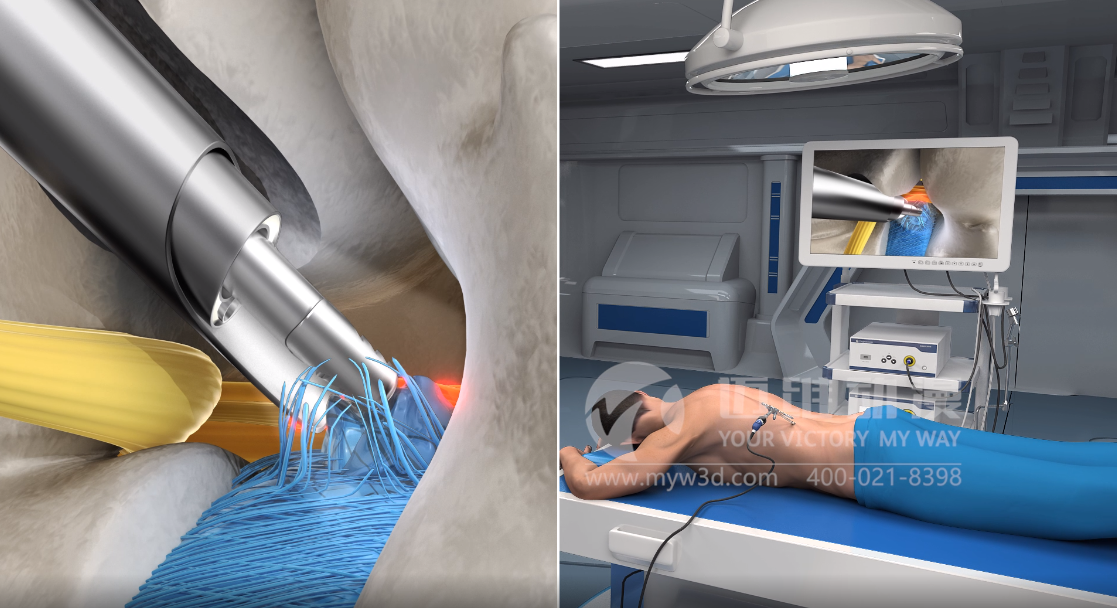 三維動(dòng)畫設(shè)計(jì)助力醫(yī)學(xué)醫(yī)療行業(yè)健康發(fā)展！(圖4)