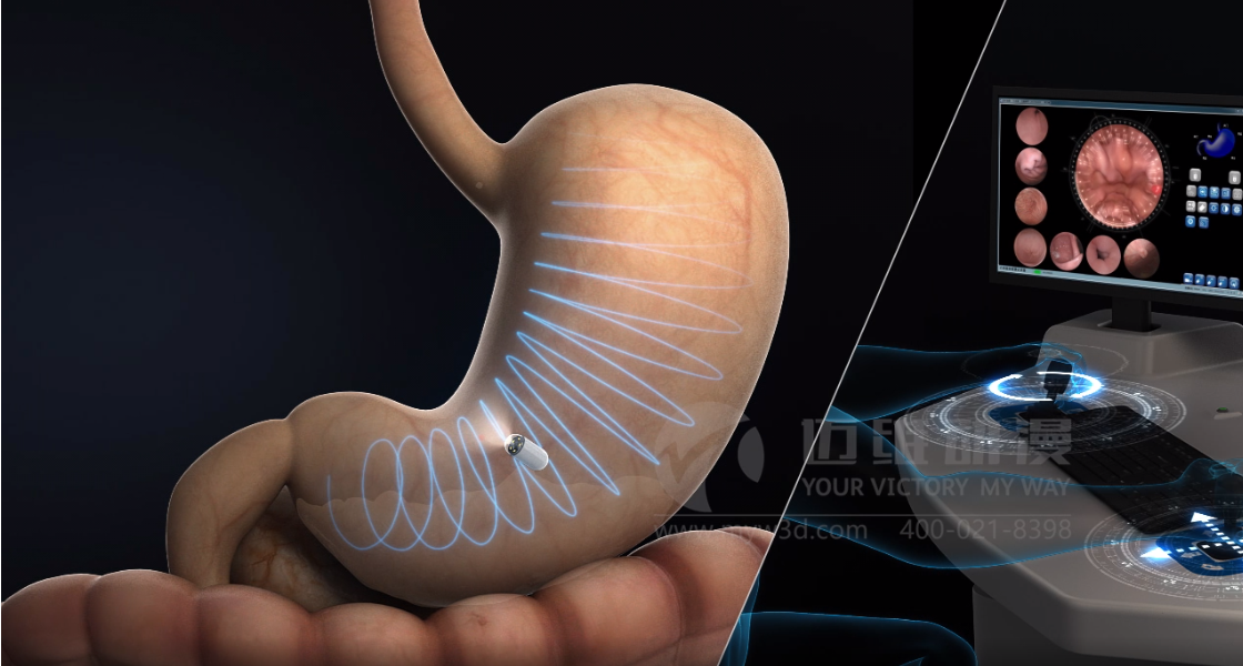 醫(yī)學(xué)醫(yī)療行業(yè)為什么青睞于三維動畫？(圖3)