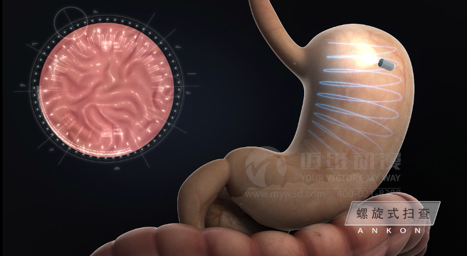 醫(yī)用設(shè)備三維動畫制作好處有哪些？(圖2)