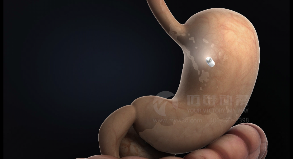 醫(yī)用設(shè)備三維動畫制作好處有哪些？(圖1)