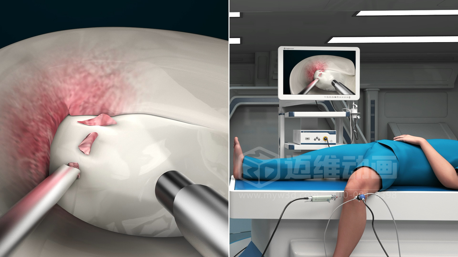 三維動(dòng)畫制作在展現(xiàn)醫(yī)療器械方面能給企業(yè)帶來諸多優(yōu)勢，這5點(diǎn)不容忽視！(圖3)
