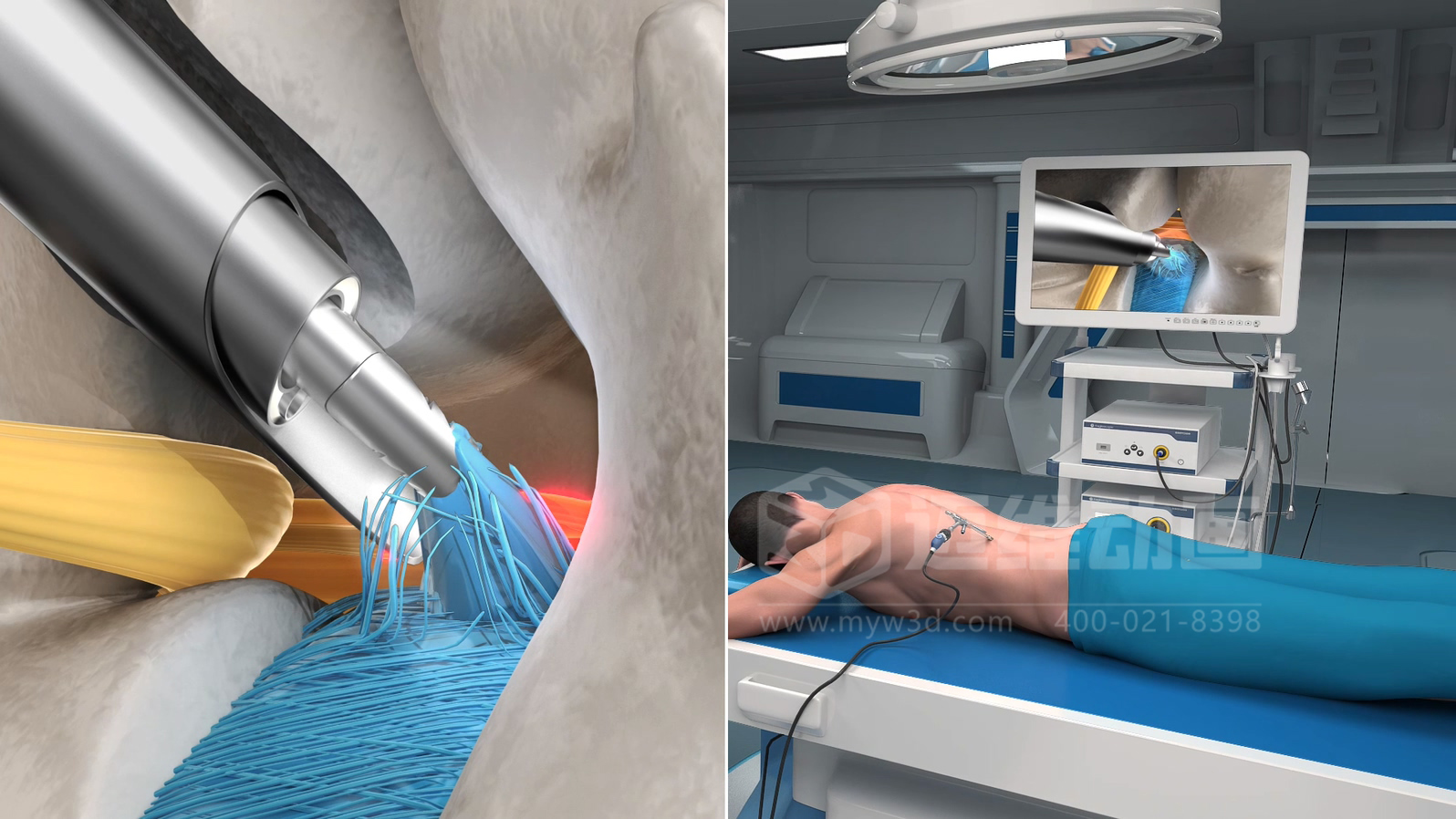 企業(yè)制作工程施工|自動化生產(chǎn)線|產(chǎn)品演示|醫(yī)學(xué)行業(yè)三維動畫要準(zhǔn)備哪些資料，以便有效地提供給三維動畫制作公司呢？(圖7)