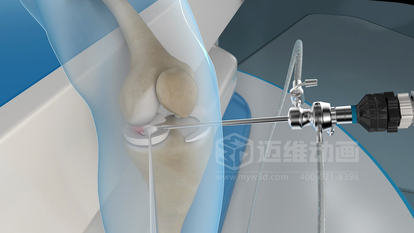 醫(yī)學手術(shù)三維動畫制作公司哪家好？解碼上海邁維動漫的醫(yī)學醫(yī)療3D可視化創(chuàng)新之路(圖1)
