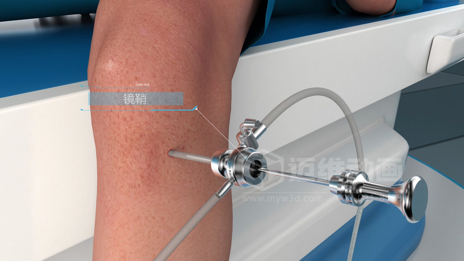 醫(yī)學手術(shù)三維動畫制作公司哪家好？解碼上海邁維動漫的醫(yī)學醫(yī)療3D可視化創(chuàng)新之路(圖2)