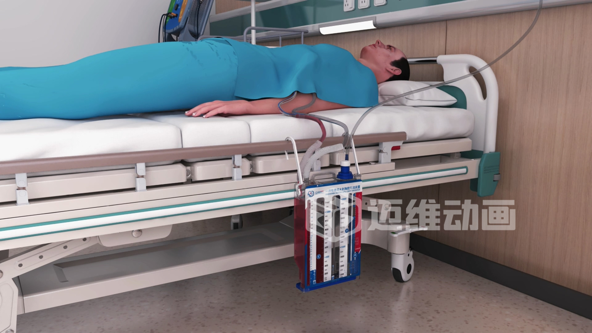 水封胸腔引流裝置三維動(dòng)畫 水封胸腔引流裝置三維動(dòng)畫
