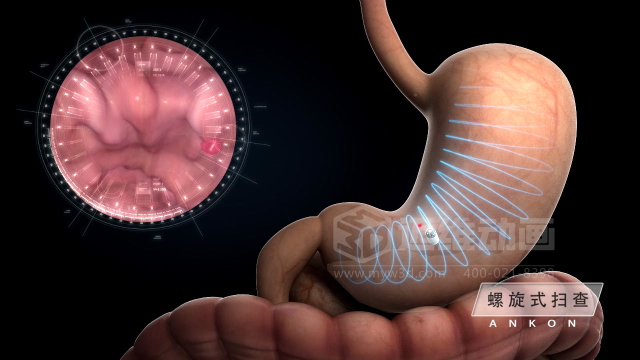 從實驗室到手術(shù)室：邁維動漫用三維動畫，讓精密科技“看得見，懂得到”訂單轉(zhuǎn)化率提高 50%(圖3)