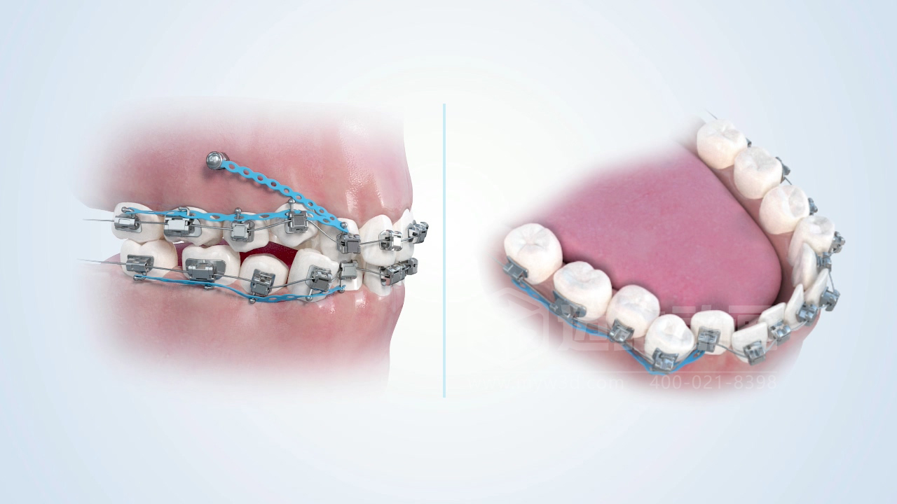 從實驗室到手術(shù)室：邁維動漫用三維動畫，讓精密科技“看得見，懂得到”訂單轉(zhuǎn)化率提高 50%(圖10)