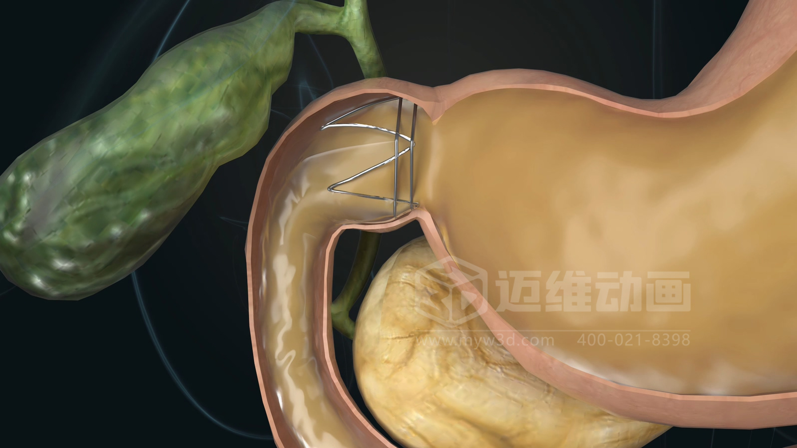 醫(yī)學科普從來不是 “天書”：三維動畫讓復雜科學原理輕松 get！(圖12)